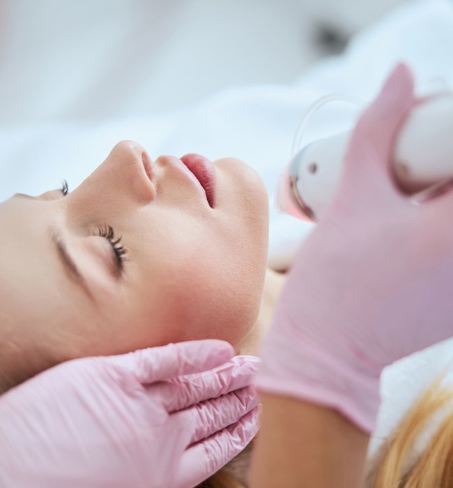 microneedling