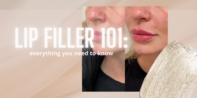 Lip Filler 101: Everything You Need to Know