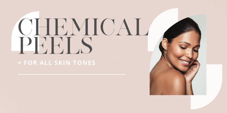 Chemical Peels For All Skin Tones